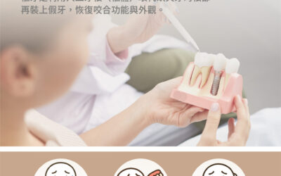 缺牙的影響，不僅是外觀。