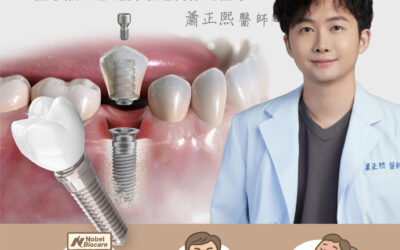 🦷 為什麼植牙價格落差這麼大？