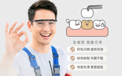 【全瓷冠｜抽菸之後 還敢放心笑嗎？】