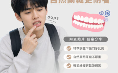 【陶瓷貼片｜笑容失焦？自然關縫更耐看】