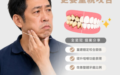【全瓷冠｜牙齒壞掉了 更要重視咬合】