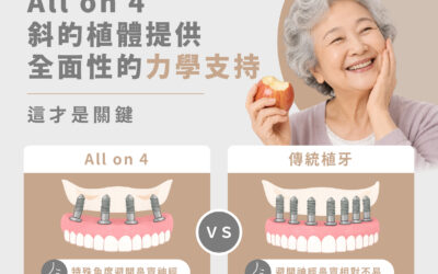 All-on-4只靠4顆植體,真的能撐起整排牙齒嗎?