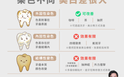 🦷 牙齒不夠白，真的一定是美白次數不夠嗎？