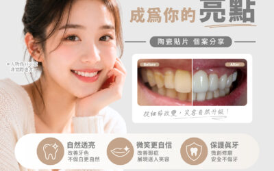 【陶瓷貼片|讓微笑成為你的亮點】