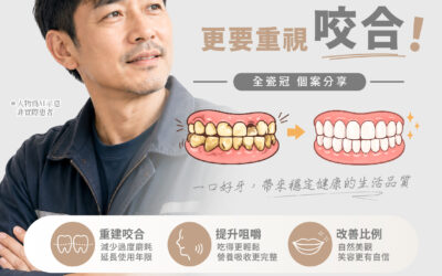 【全瓷冠|牙齒壞掉了,更要重視咬合!】