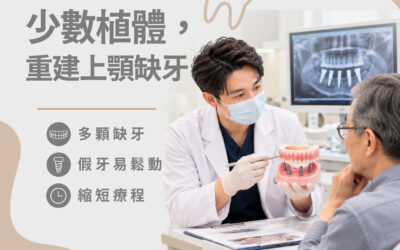 全口重建為什麼要評估咬合？假牙設計與植體配置的關係